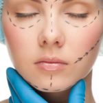 teenagers cosmetic procedures